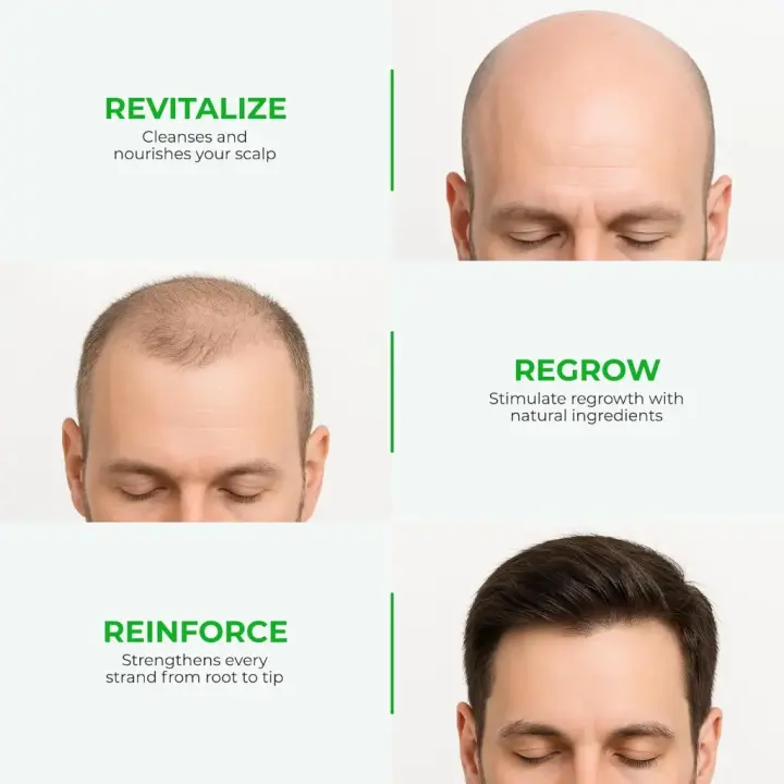 Neo Hair Lotion Paradise – Herbal Hair Regrowth Solution